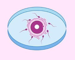 O-que-é-e-como-é-feita-a-Fertilização-In-Vitro_edited_edited.jpg