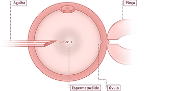 icsi.webp