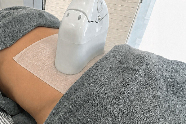 エアリアルのメンズ脂肪冷却痩身