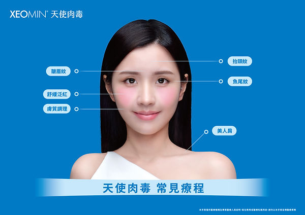 圖片7 天使肉毒 適合治療項目／部位.jpg