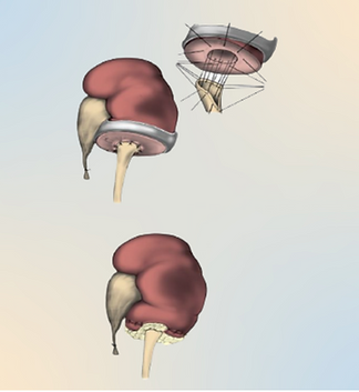 Untitled design (2).png