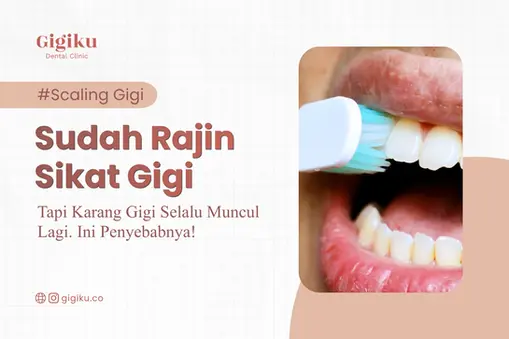 Karang Gigi Tidak Hilang Hanya Dengan Menyikat Gigi