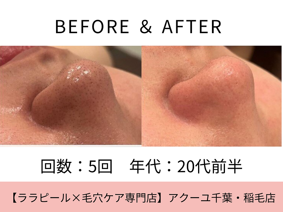Before&After