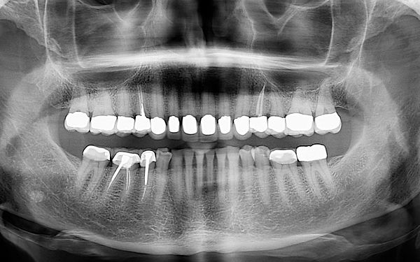 Hygiene | Dr. Sergio Rubinstein