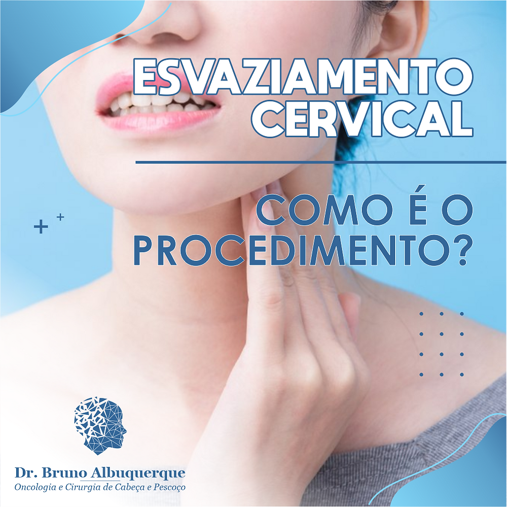 Esvaziamento cervical como é o procedimento? Esvaziamento cervical como é o procedimento?