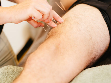 How Does Dry Needling Benefit Your Body and Recovery Process?