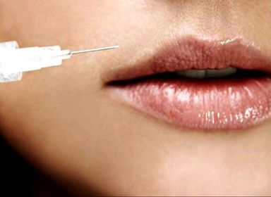 8 coisas que deve saber antes de fazer preenchimento labial
