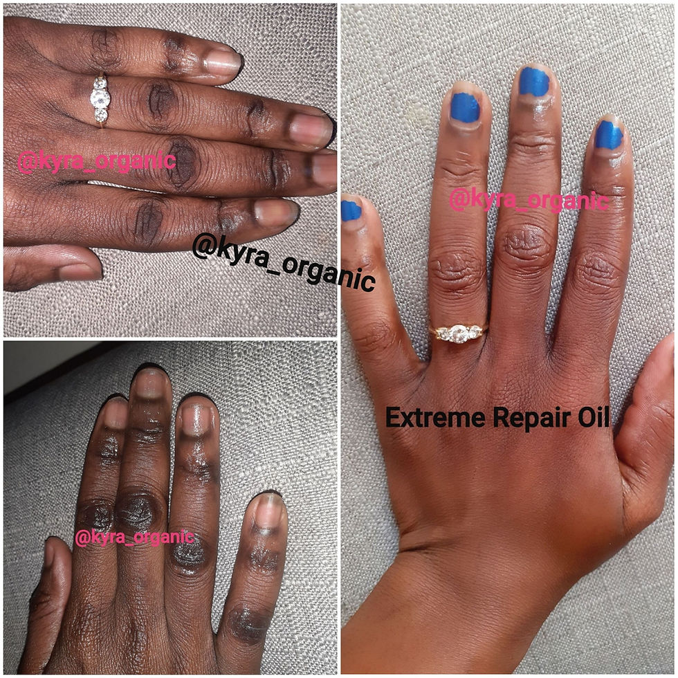 Thumbnail: Extreme Repair Oil