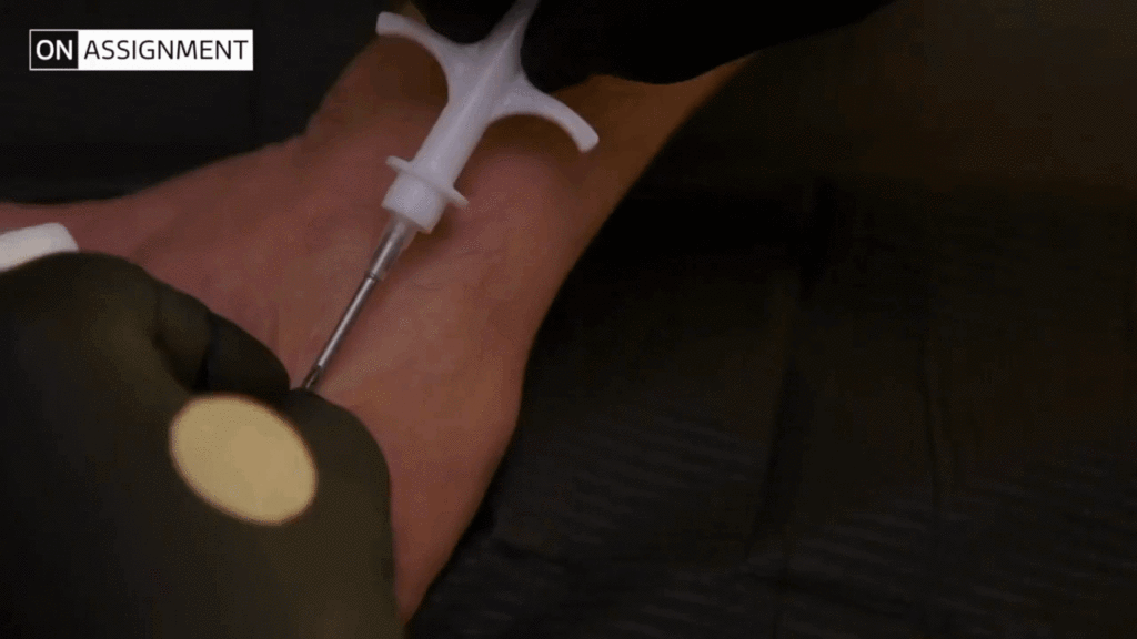 rfid inserted