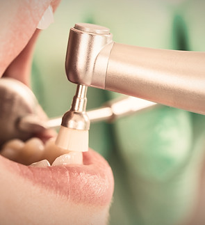 Dental Cleaning_edited.jpg