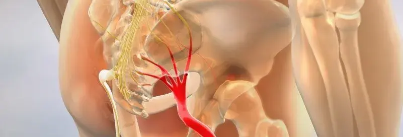 Sciatica-Treatment-e1582133713751.webp