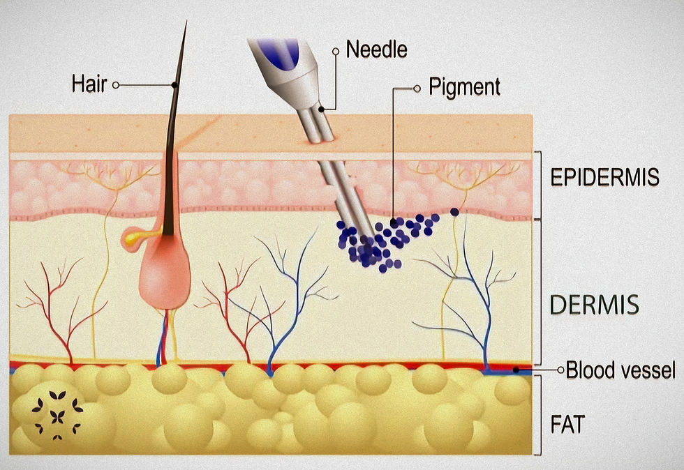A cross section of the different layers of human skin, along with indications of where tattoo ink sits, in the dermis under the epidermis.