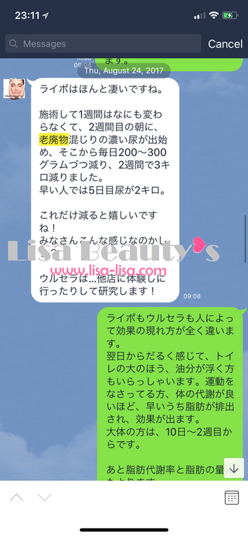 ライポソニック７５Ｊ