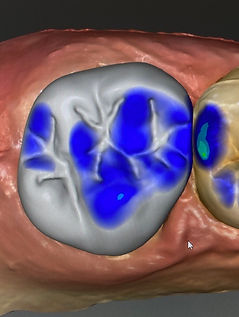 Tooth scan