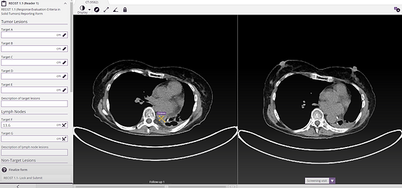 RECIST 1.1 assessment form in SliceVault