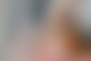 COLÁGENO HIDROLIZADO: MUCHO MÁS QUE UNA SOLUCION ANTIARRUGAS