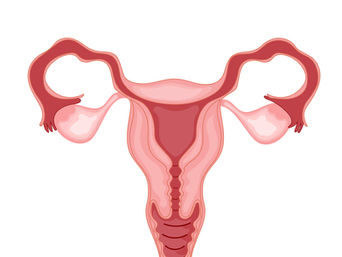 Pólipo endometrial: vou ter câncer de útero?