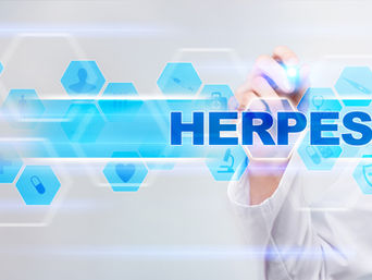 Herpes Simples