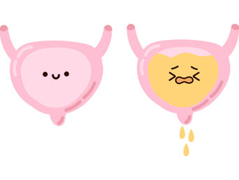 Por que é importante tratar a incontinência urinária logo após o diagnóstico?