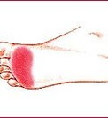 foot metatarsalgia_edited.jpg