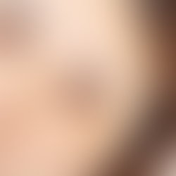 小顔効果、たるみ・面長改善にお薦め！上下のまつ毛パーマ