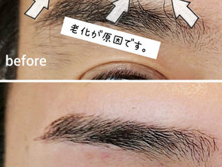 【40代・50代の謎】なぜ歳をとると「眉毛が数本だけ長ーく伸びる」のか?原因とプロの解決策