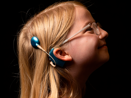 O que é a Síndrome de Usher e como ela afeta a audição?