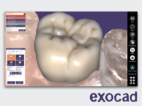 תוכנת exocad Chairside