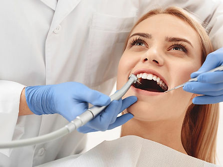 Teeth Filling 