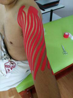 Drenaje linfático en brazo