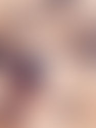 Cuidado de la piel en tiempo de frió.