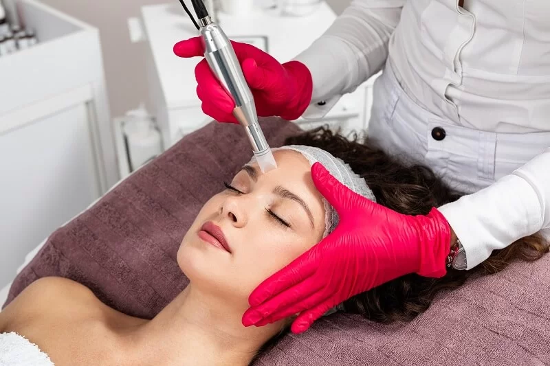 what-is-microneedling.webp