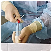 INSEMINACIÓN ARTIFICIAL
