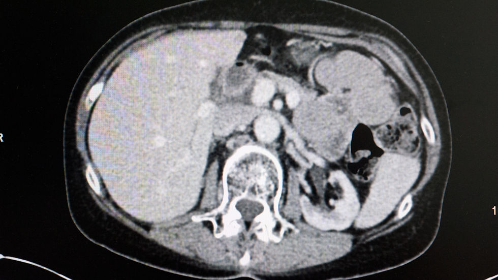 ct-scan.jpg