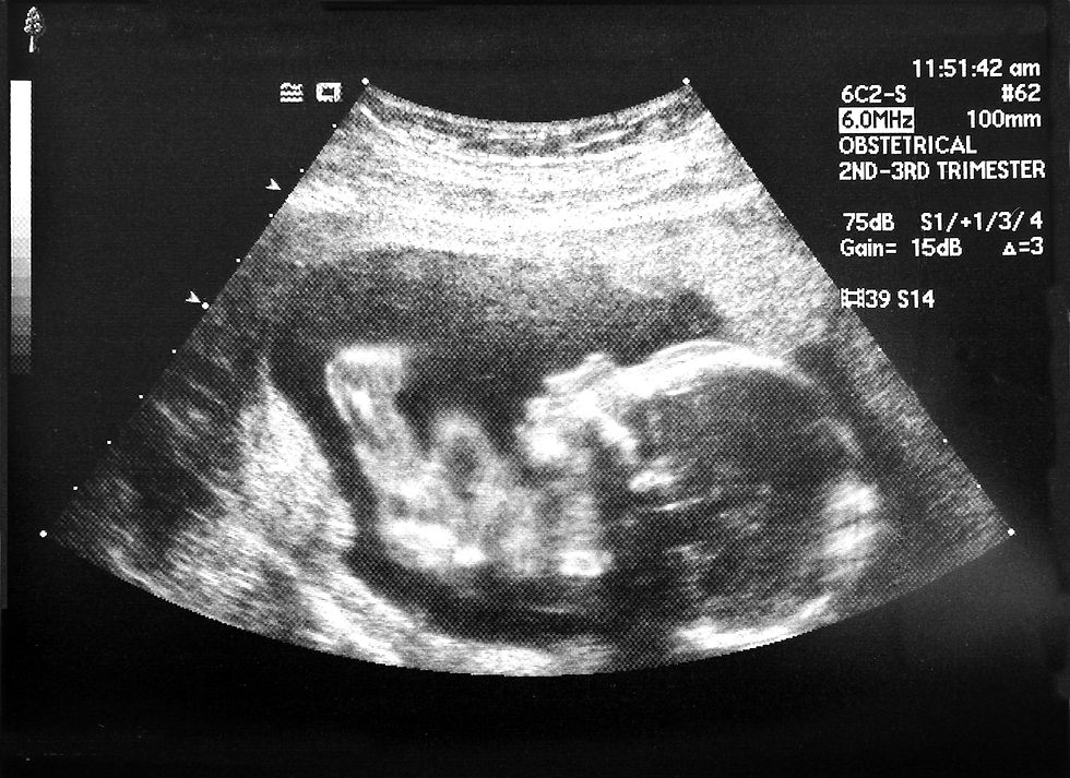 Ultrasound Scan Image