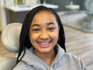 How braces are put on your teeth
