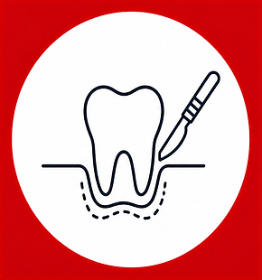Dentaltre-trattamenti-chirurgia-orale.png