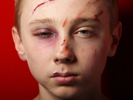 The Karate kid who got beat up!