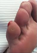 Cor pulpaire.jpg