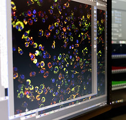 Brain cell response_crop.jpg