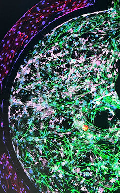 Microfluidic BBB_edited.jpg
