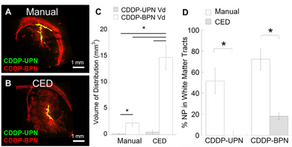 Convection enhanced delivery of cisplatin-loaded brain penetrating nanoparticles cures glioma
