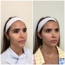 Dra-Jaclyn-dermatologa-en-panama