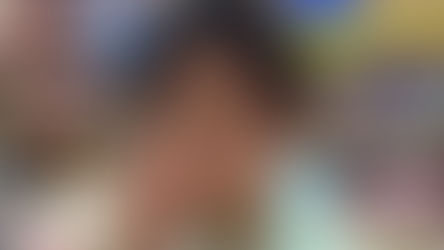 בת 4 בלעה סיכת חיג'אב ד"ר אבי און חילץ את הסיכה בהצלחה