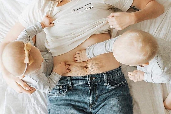 Postnatal jumeaux