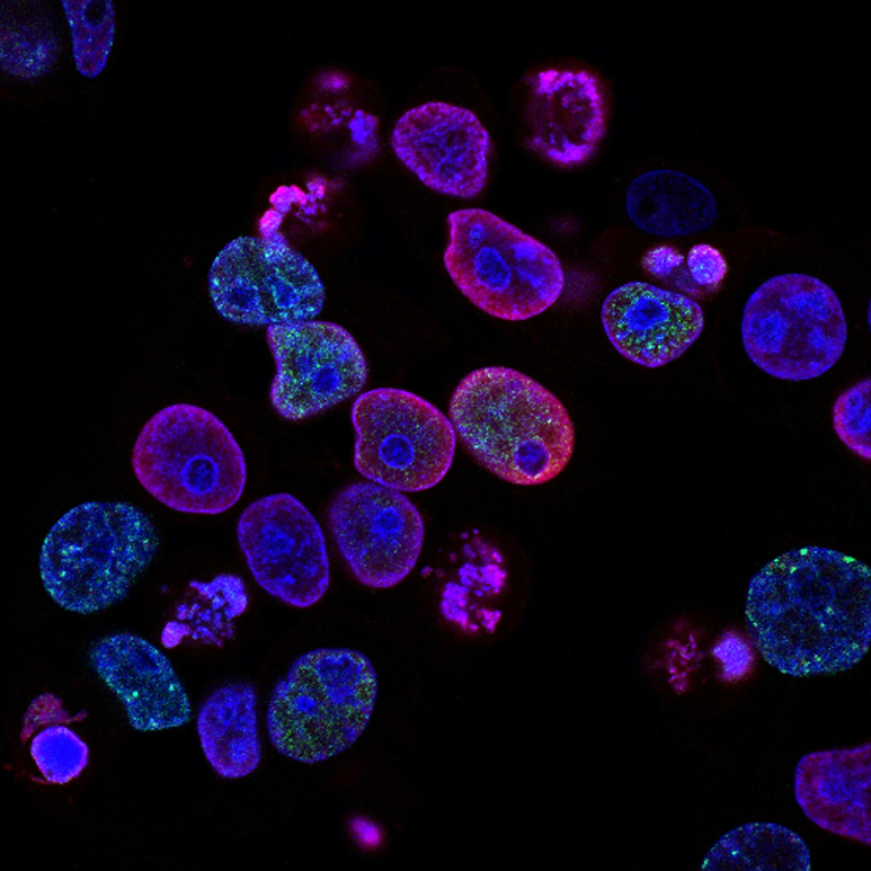 Adherent colorectal cancer cells seen under a microscope