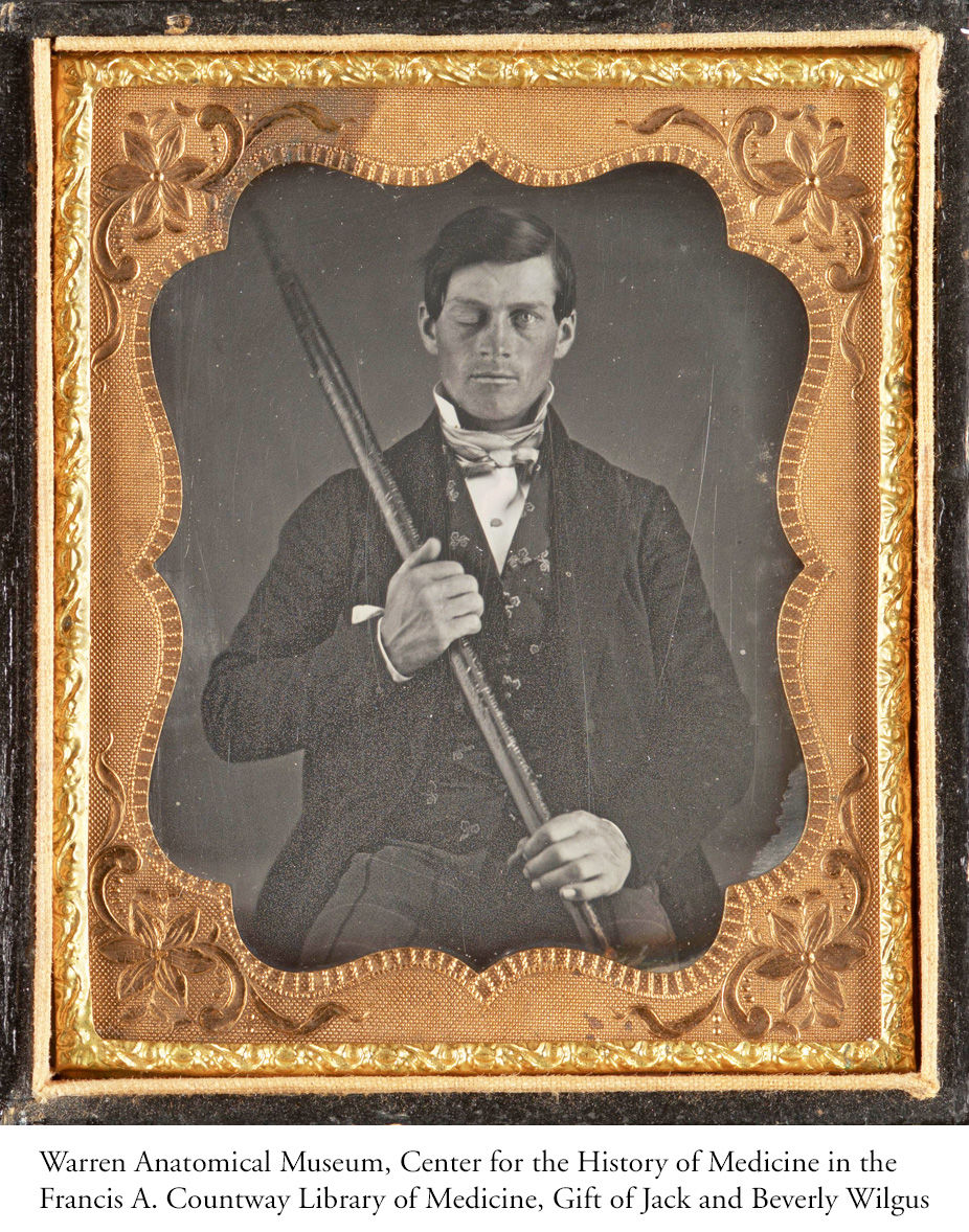 Phineas Gage, old photo, oddities, curiosities