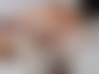 What Is RF Microneedling and Why Is It Trending in Cleveland?