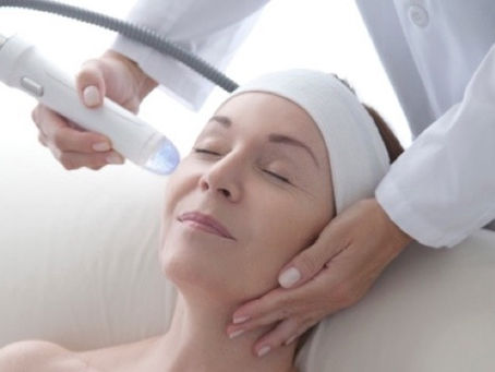 How Can I Find the Best Clinic Offering Vivace Ultra Near Cleveland?