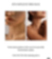 Neck Rejuvenation